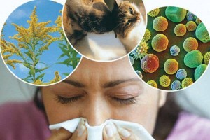 Как пережить аллергию?