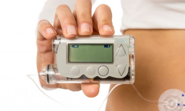 Минздрав Забайкалья собирает данные о нуждающихся в расходниках к инсулиновым помпам